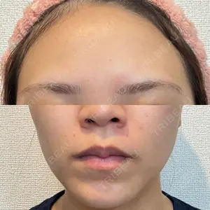 ルラ美容クリニック 静岡院口コミ