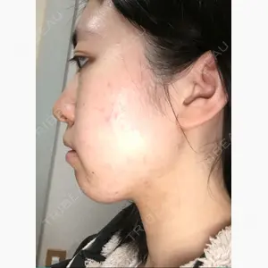 湘南美容クリニック 大宮院口コミ