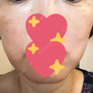B-LINE CLINIC 大阪院口コミ
