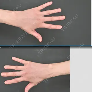 Lipo Clinic omotesando口コミ