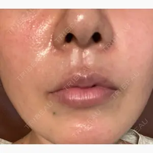 メディアージュクリニック 福岡院口コミ