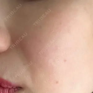 麻布台美容皮膚科クリニック口コミ