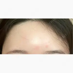 AB美容クリニック 新宿院口コミ