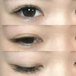 共立美容外科 高崎院口コミ