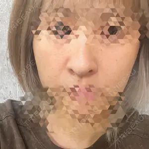 サラン鶴橋皮フ科口コミ