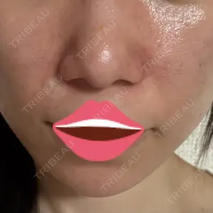 東京美容医療クリニック 池袋院口コミ