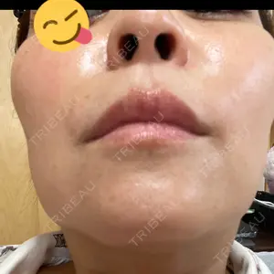 YVESJU CLINIC （イヴジュクリニック） 表参道院口コミ