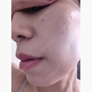 ワンストップヘアクリニック 大阪院口コミ