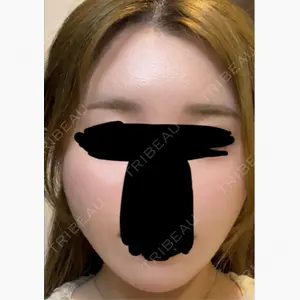 小倉美容外科ネビュラクリニック口コミ