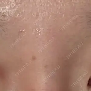 S-Laboクリニック 渋谷院口コミ