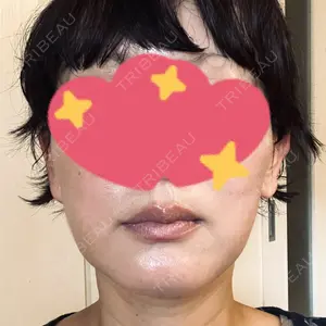DAILY SKIN CLINIC 心斎橋院口コミ