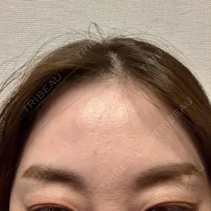 美容皮膚科エルムクリニック 福岡院口コミ