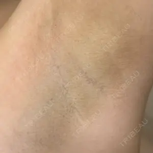 グランジョイクリニック口コミ