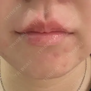 小倉美容外科ネビュラクリニック口コミ