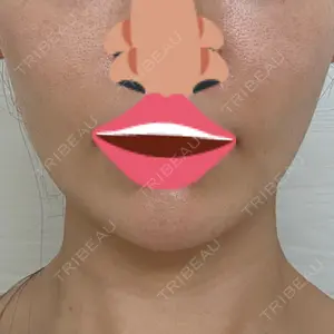 TCB東京中央美容外科 草津院口コミ