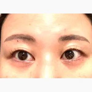 ルーチェクリニック 銀座院口コミ