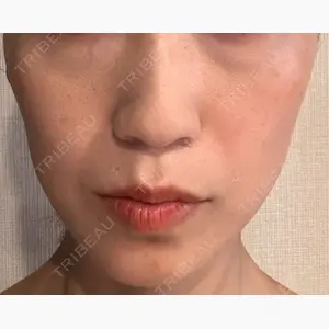 Nクリニック伏見口コミ