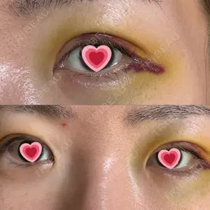 サクラアズクリニック 心斎橋院口コミ