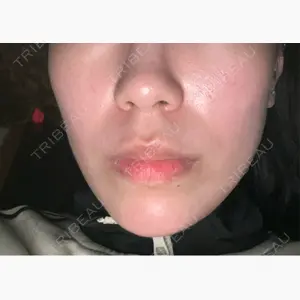 東京美容外科 札幌院口コミ