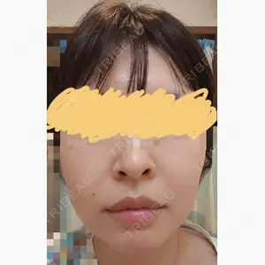 TCB東京中央美容外科 新宿西口院口コミ