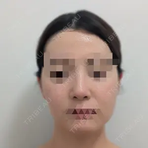 東京ヒルズクリニック 銀座院口コミ