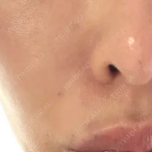 PRISM Beauty Clinic口コミ