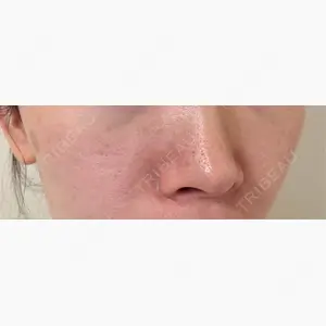 YVESJU CLINIC （イヴジュクリニック） 表参道院口コミ