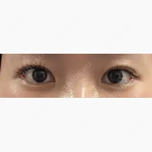 R Beauty CLINIC 銀座院口コミ