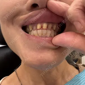 A CLINIC（エークリニック） デンタル 銀座口コミ