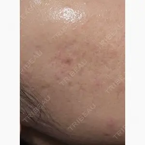 湘南美容クリニック 仙台院口コミ