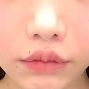 東京美容医療クリニック 池袋院口コミ