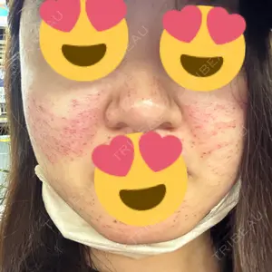 BAO CLINIC 梅田院口コミ