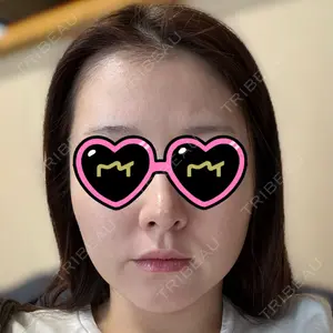 Zetith Beauty Clinic 新宿院口コミ