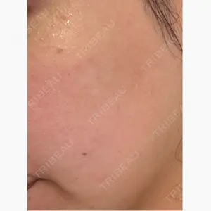 CZEN CLINIC 銀座院口コミ