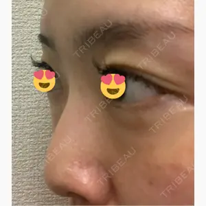 HAAB×DREAM BEAUTY CLINIC 東京本院口コミ