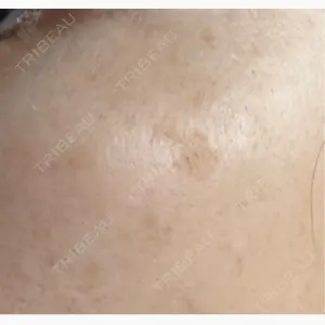 Clinic K Blossom口コミ