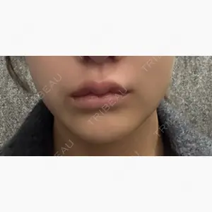 東京美容外科 札幌院口コミ