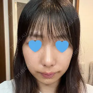 セギム美容整形外科口コミ