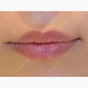 LOUIS CLINIC 二子玉川院【ルイクリニック】口コミ