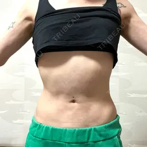 脂肪吸引ラボトウキョウ口コミ