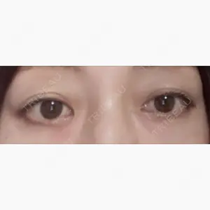 小倉美容外科ネビュラクリニック口コミ