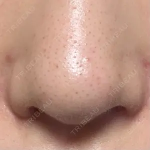 GLANZ CLINIC口コミ