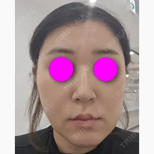 東京シンデレラ美容外科 池袋院口コミ