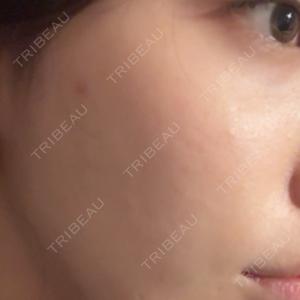 ルラ美容クリニック 池袋院口コミ