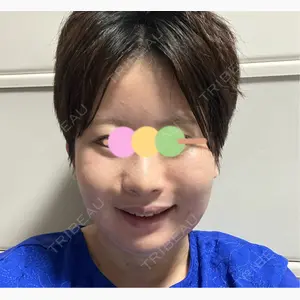 コントアクリニック 東京口コミ