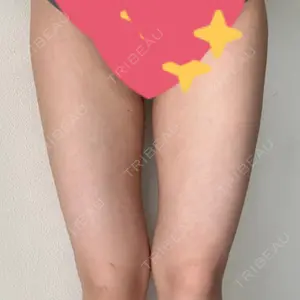 ヴェルトラクリニック 大阪院口コミ