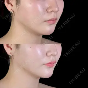 アリエル美容クリニック 郡山院口コミ