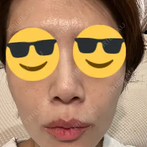 Zetith Beauty Clinic 新宿院口コミ