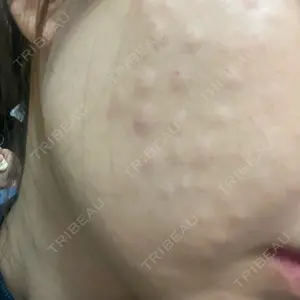 サラン鶴橋皮フ科口コミ