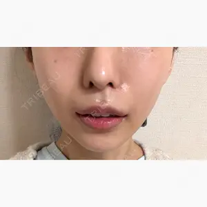 EMMO FACE CLINIC 東京三田院口コミ